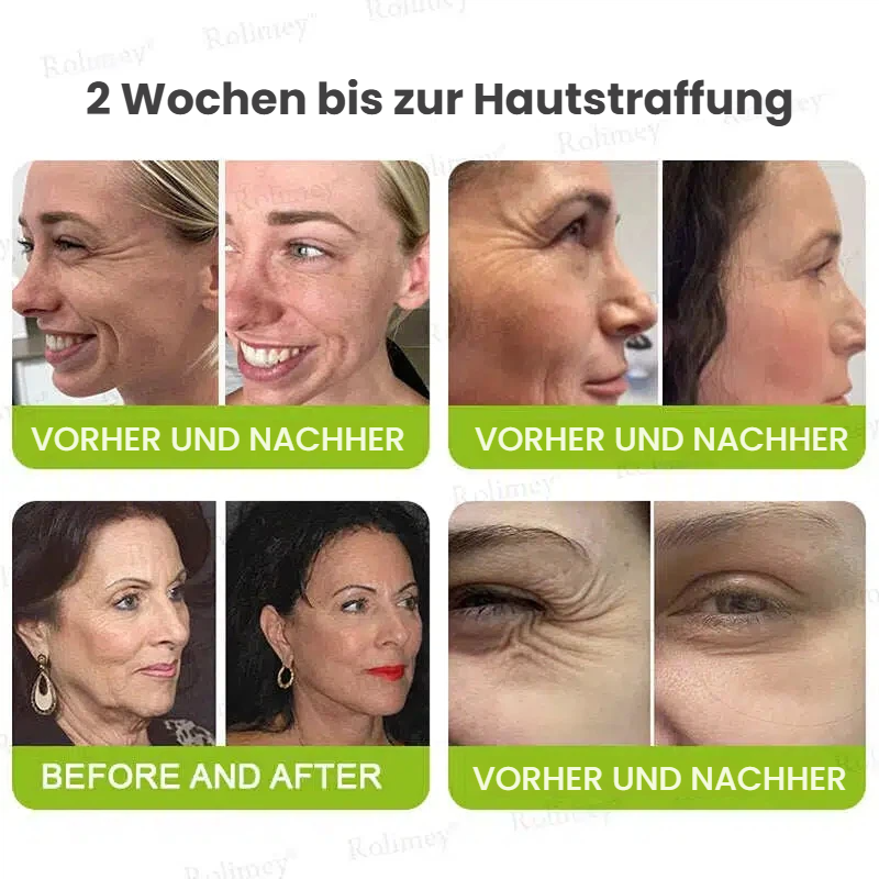 🥯70 % RABATT – Nur heute! Sichtbare Hautstraffung & Faltenpflege Direkt aus Deutschland · Jetzt sichern!