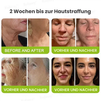 🥯70 % RABATT – Nur heute! Sichtbare Hautstraffung & Faltenpflege Direkt aus Deutschland · Jetzt sichern!
