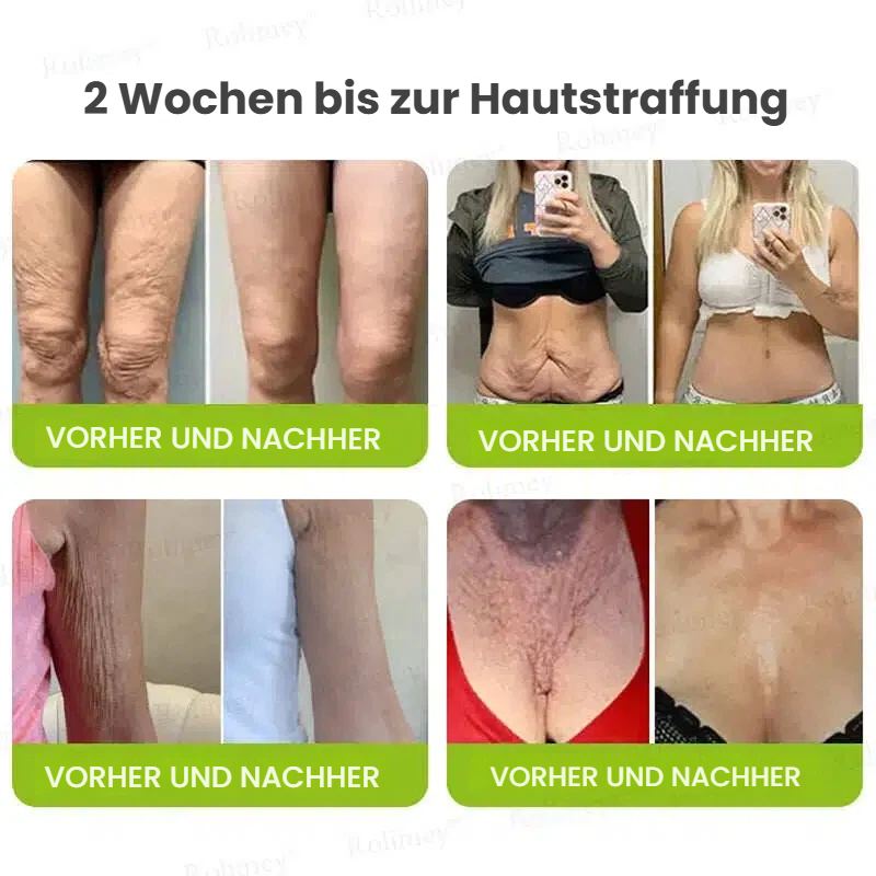 🥯70 % RABATT – Nur heute! Sichtbare Hautstraffung & Faltenpflege Direkt aus Deutschland · Jetzt sichern!