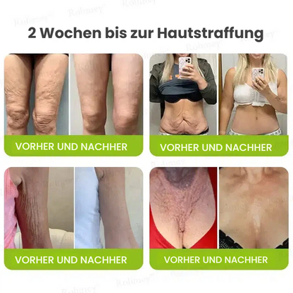🥯70 % RABATT – Nur heute! Sichtbare Hautstraffung & Faltenpflege Direkt aus Deutschland · Jetzt sichern!