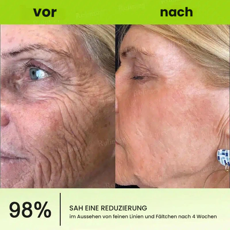 🥯70 % RABATT – Nur heute! Sichtbare Hautstraffung & Faltenpflege Direkt aus Deutschland · Jetzt sichern!