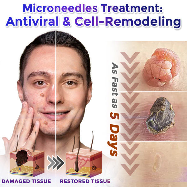 🍁🌟Celsiora® Multi-Functional Microneedle Hydrocolloid Patch Roll | Targets Skin Tags, Warts & Stubborn Blemishes